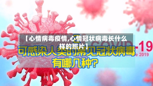 【心情病毒疫情,心情冠状病毒长什么样的照片】-第2张图片