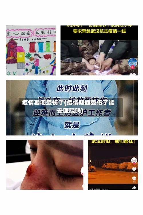 疫情期间受伤了(疫情期间受伤了能去医院吗)-第2张图片