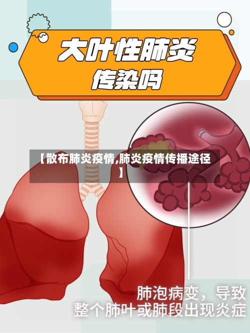 【散布肺炎疫情,肺炎疫情传播途径】-第2张图片