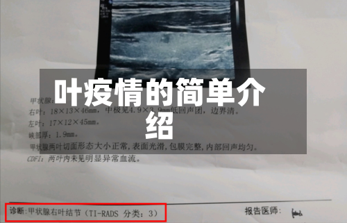 叶疫情的简单介绍-第2张图片