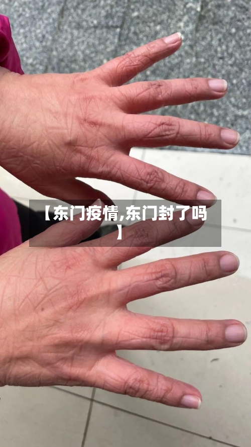 【东门疫情,东门封了吗】