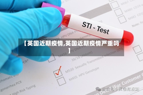 【英国近期疫情,英国近期疫情严重吗】-第2张图片