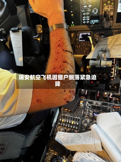 瑞安航空飞机因窗户脱落紧急迫降