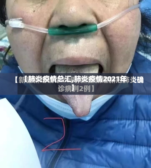 【肺炎疫情总汇,肺炎疫情2021年】-第2张图片